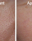 image avant-après de la peau