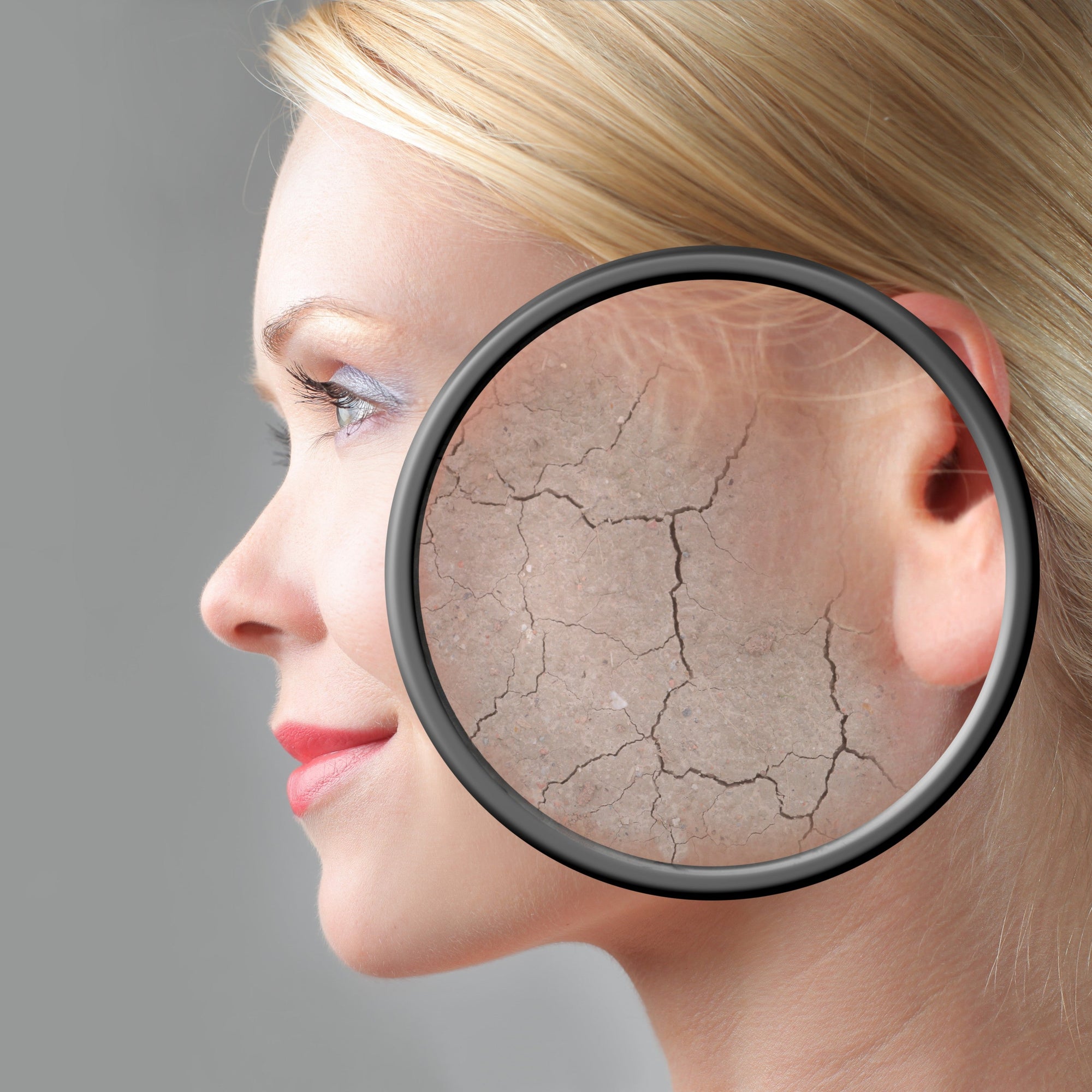 Peau sèche à très sèche