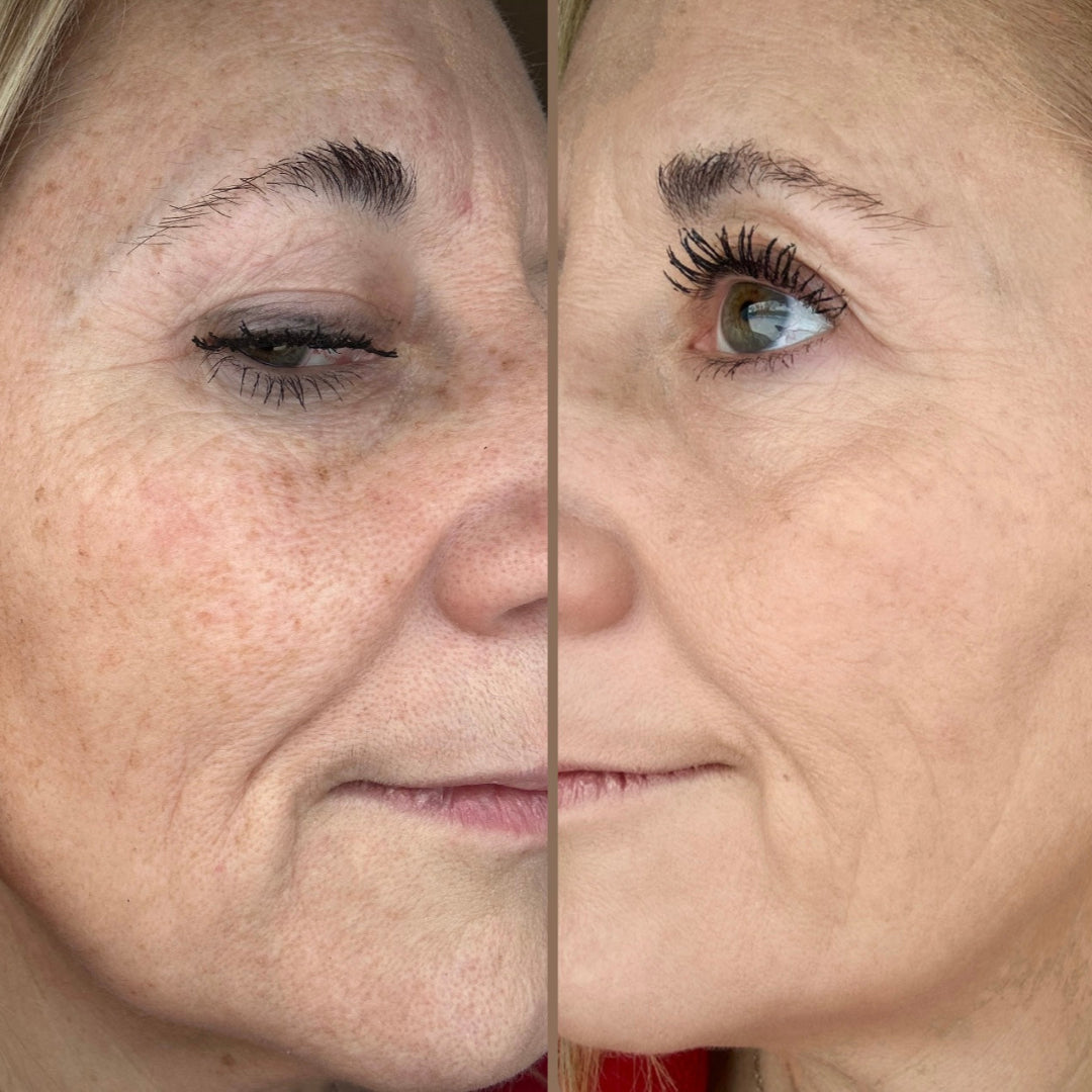 Image du côté gauche sans et côté droit avec la BB crème ARTIST