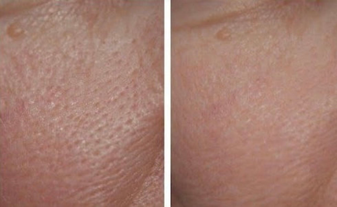 Image avant/après l'utilisation de la base ultra-lissante ARTIST