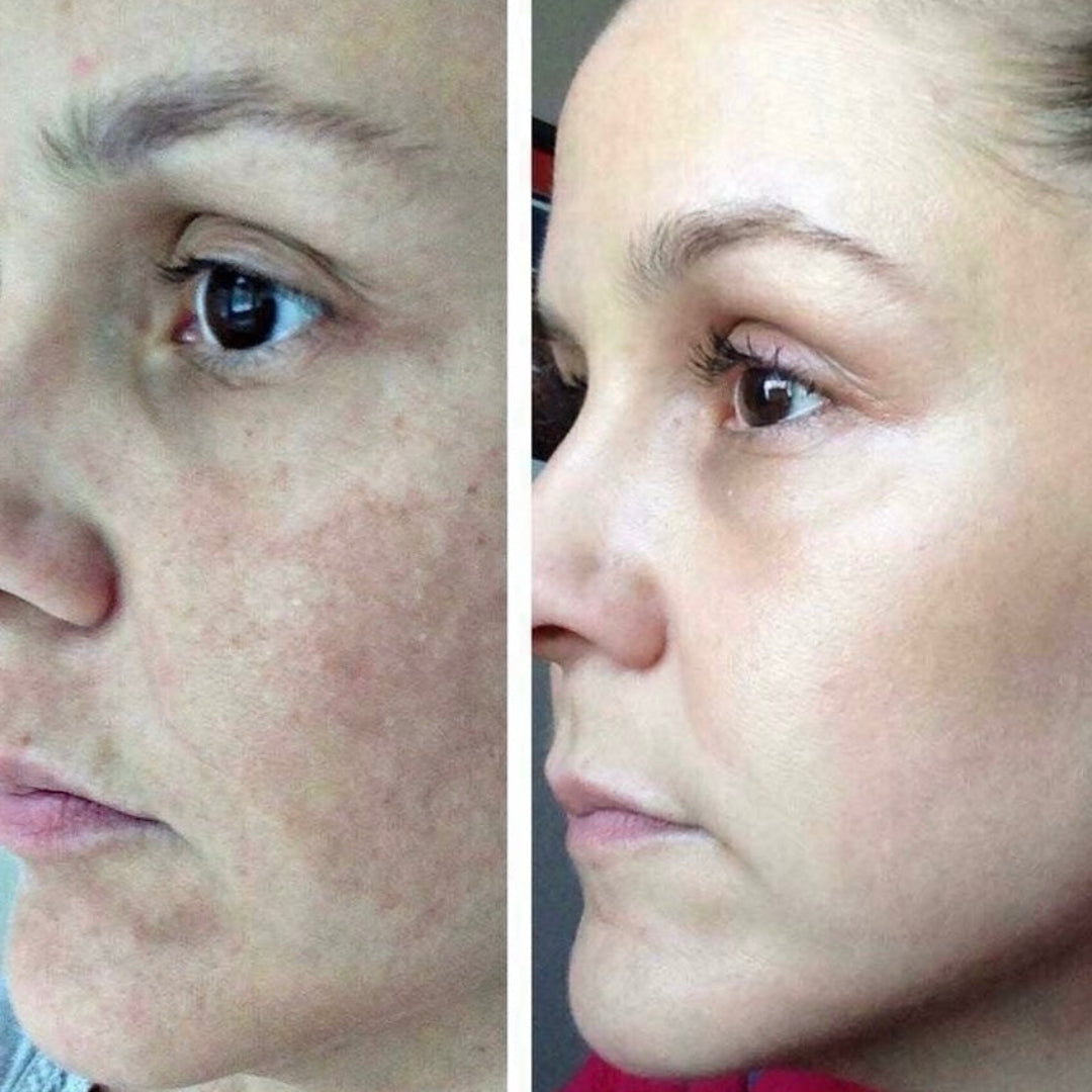 Image d'un avant/après de l'Exfoliant à la canneberge du Québec ARTIST