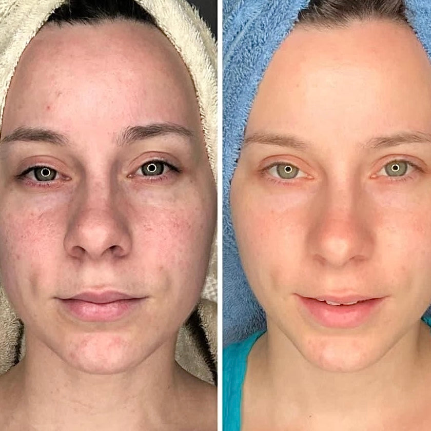 avant après avoir utilisé l'huile air ARTIST