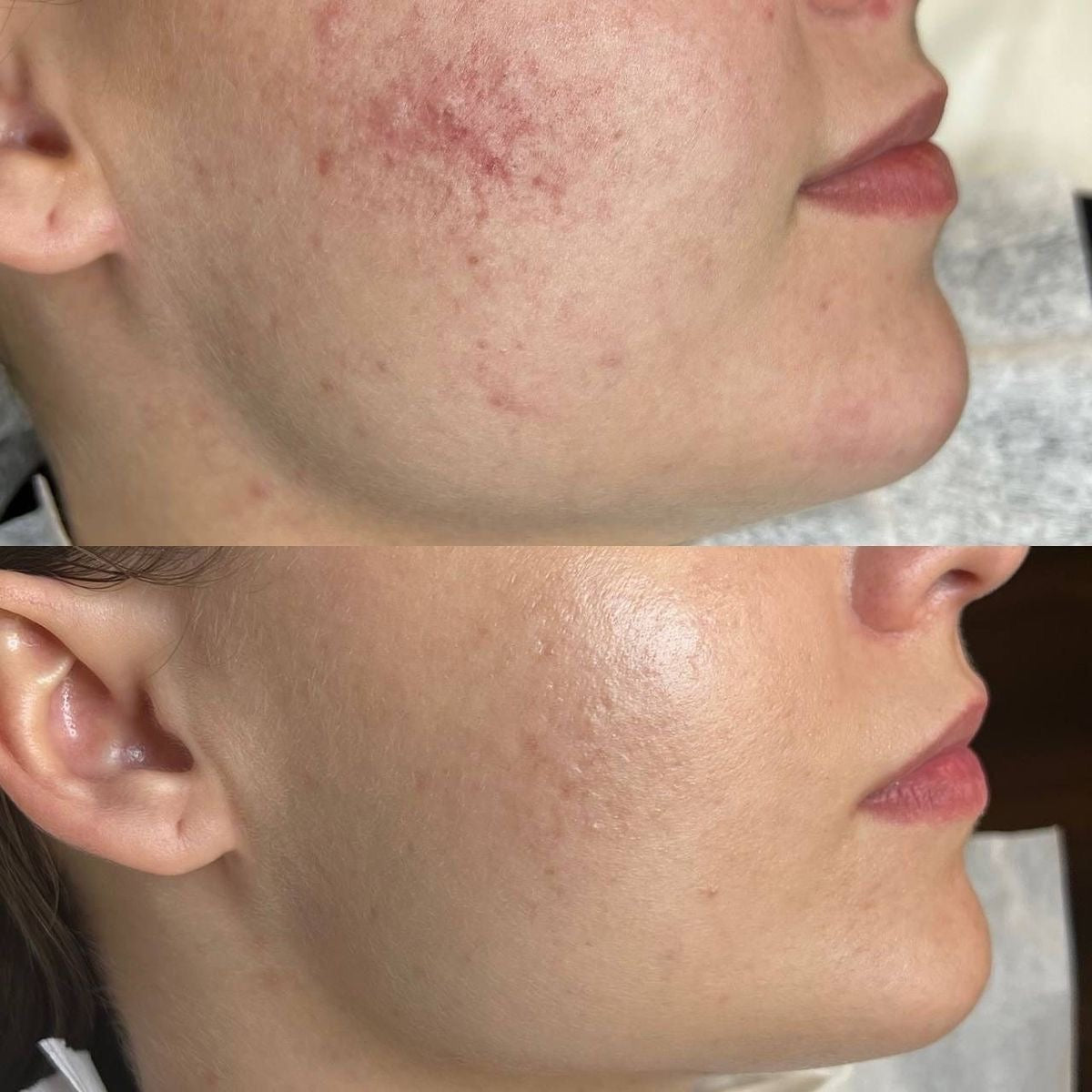 avant après avoir utilisé l'huile feu ARTIST