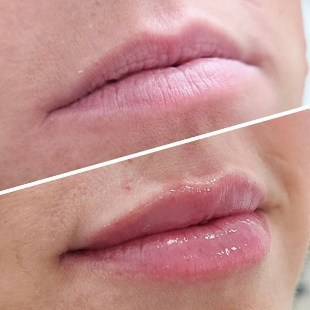 avant après avoir utilisé l'huile à lèvres ARTIST