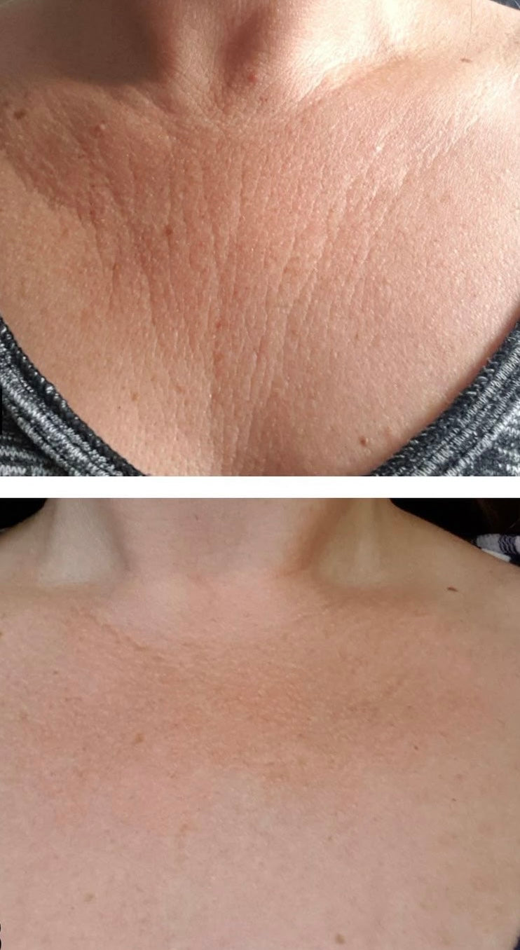 avant après avoir utilisé le lait à la canneberge ARTIST